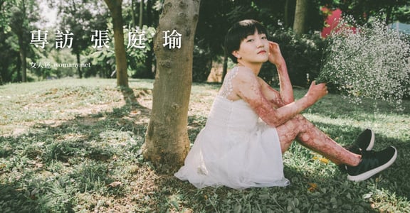 【台灣女孩日】張庭瑜：八仙塵爆後，龍紋身的女孩