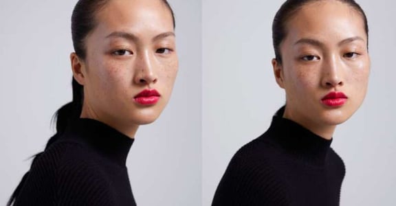 ZARA 廣告惹議，為什麼雀斑模特兒被認為「醜化」亞洲女性？