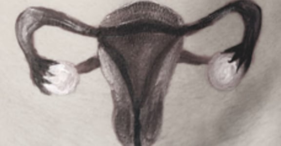 有必要切除子宮嗎？帶你從頭到尾認識子宮肌瘤
