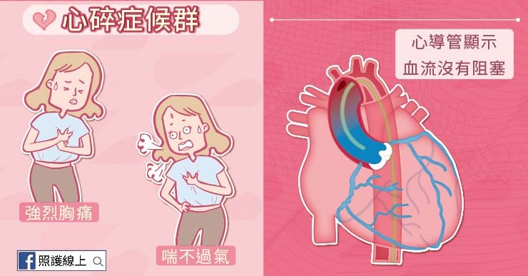 心碎症候群：強烈胸痛、心導管顯示血流沒有阻塞、喘不過氣