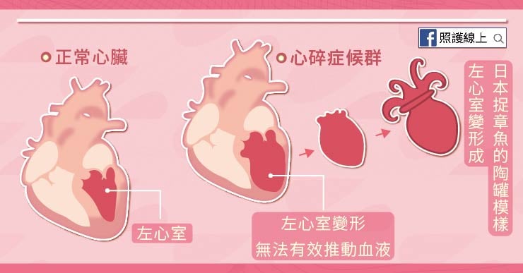 心碎症候群：左心室、左心室變形，無法有效推動血液